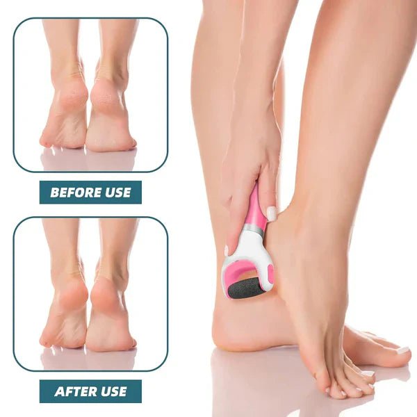 Say Goodbye to Rough Heels – The At-Home Pedicure Secret Everyone’s Talking About - Checkouts UK